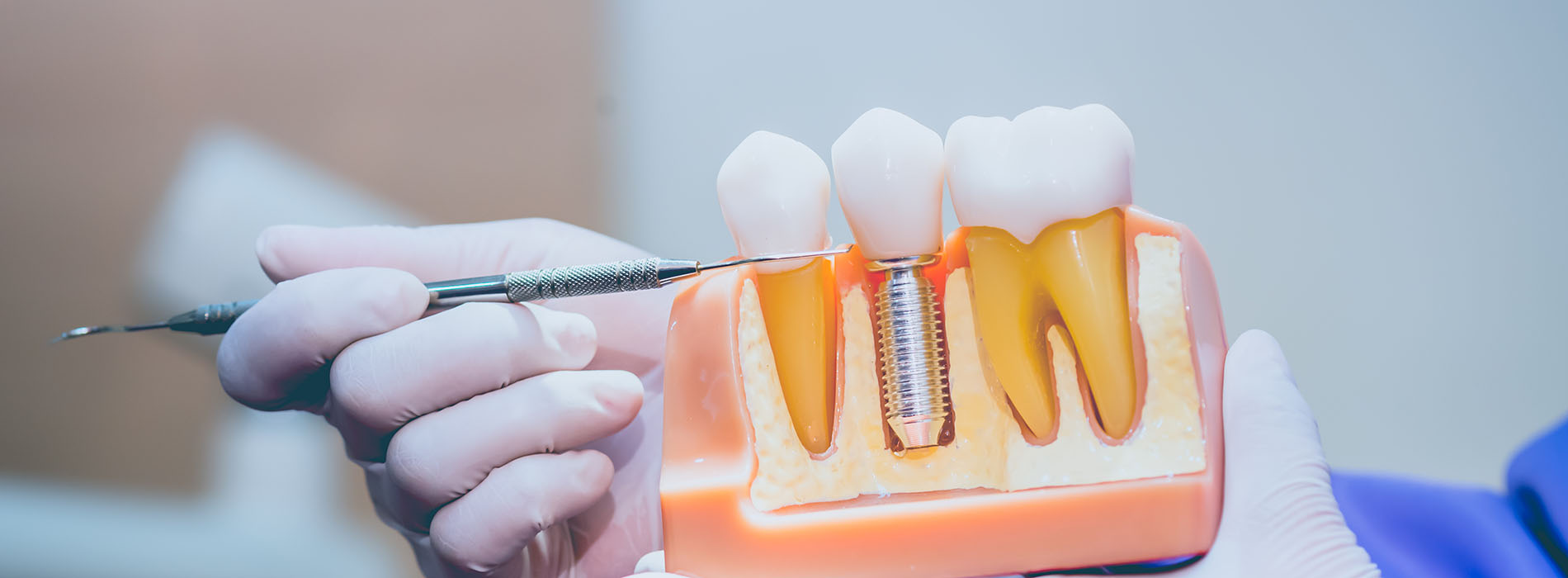 Christopher R. Szydelko, DDS PC | Fluoride Treatment, Oral Exams and Night Guards